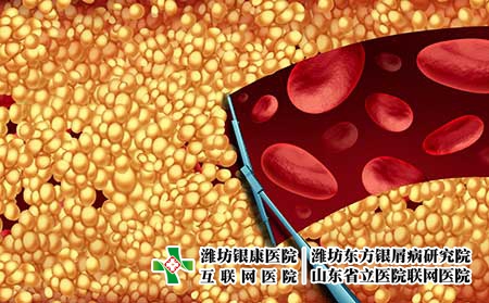 攝圖網(wǎng)_300850448_除膽固醇清潔動(dòng)脈的醫(yī)學(xué),如刮水器,清除堵塞動(dòng)脈中的斑塊,動(dòng)脈粥樣硬化疾病醫(yī)院治療的象征,打開(kāi)堵塞的靜脈三維插（企業(yè)商用）