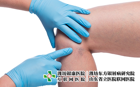 攝圖網_303522806_醫生親手檢查女腿和緊閉的容器上變血管（企業商用）