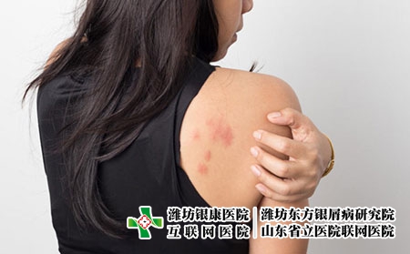 肩膀 癥狀