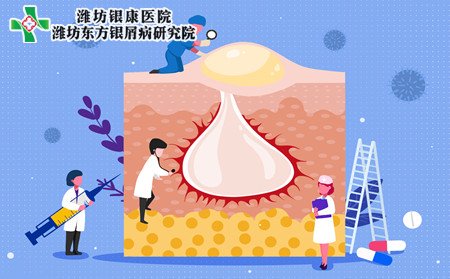 銀屑病病因,冬季銀屑病發病原因